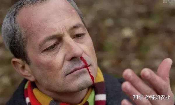 长期补硒导致血压高