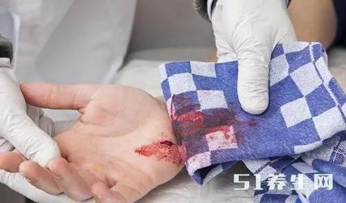 身体补硒为何脸会肿