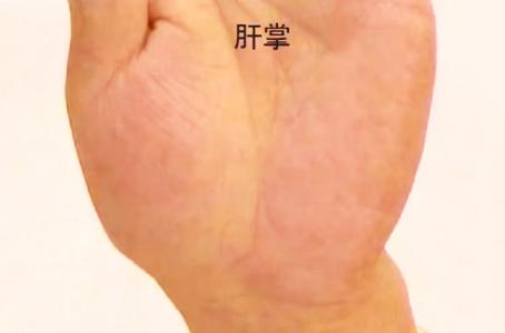 肝病可“写在”皮肤上，皮肤出现4个症状预示肝病来袭！