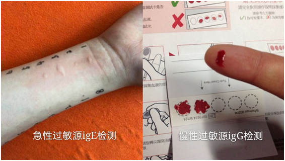 补硒会不会引起过敏