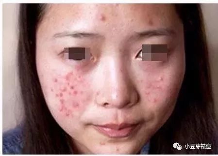 吃什么食物补硒和锌
