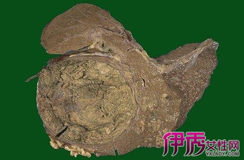 2005年科学补硒