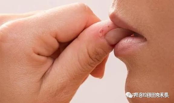 咬指甲缺什么微量元素