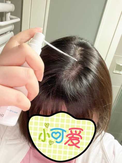 怎么能最快补硒元素