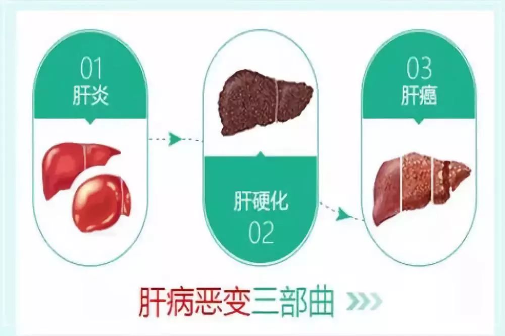 乙肝病人都要补硒吗