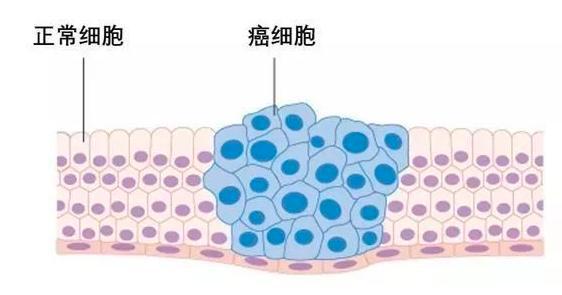 补硒对女人的重要性