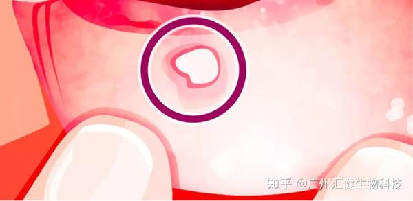 人体缺微量元素会出现什么症状(缺微量元素有什么反应)-硒宝网