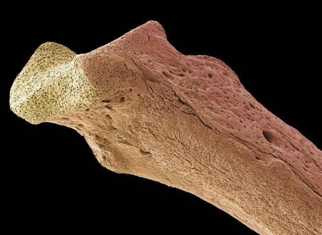 吃虾皮可以补钙吗？医生：想要补钙建议常吃这4种食物，了解下