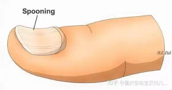 孩子缺微量元素怎么补