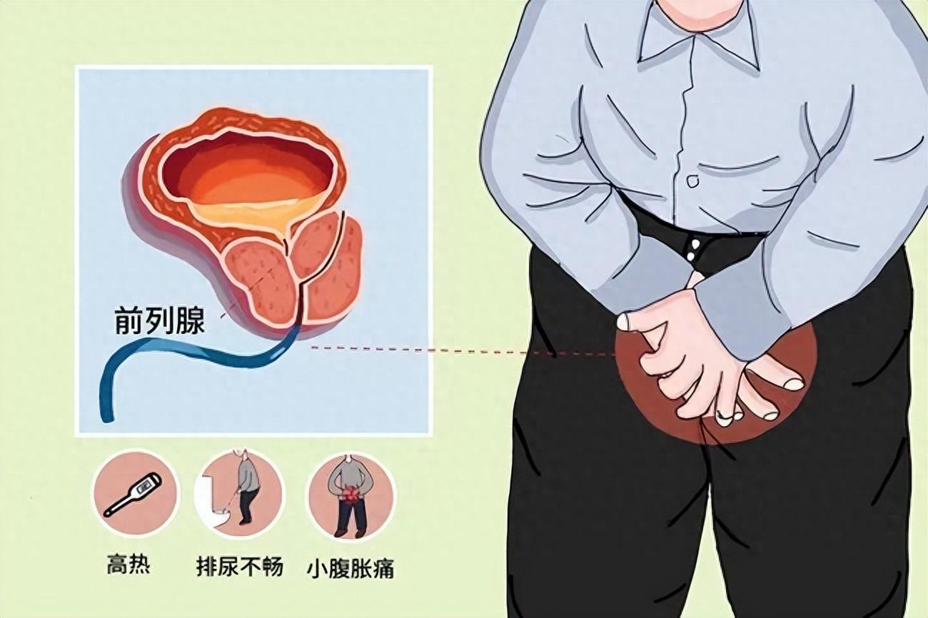 前列腺炎补硒还是锌