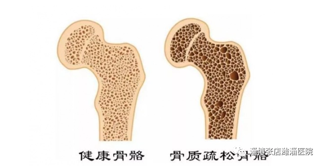补钙是液体钙好还是钙片好