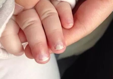 微量元素五项