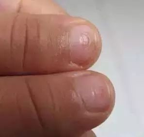 微量元素五项