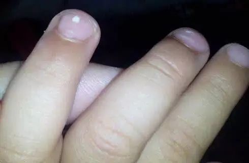 微量元素五项