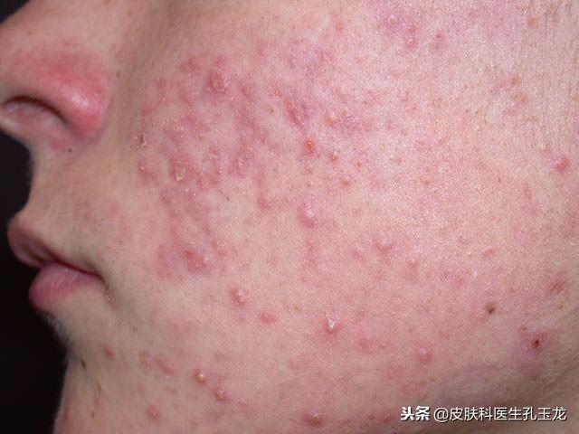 怎样补锌