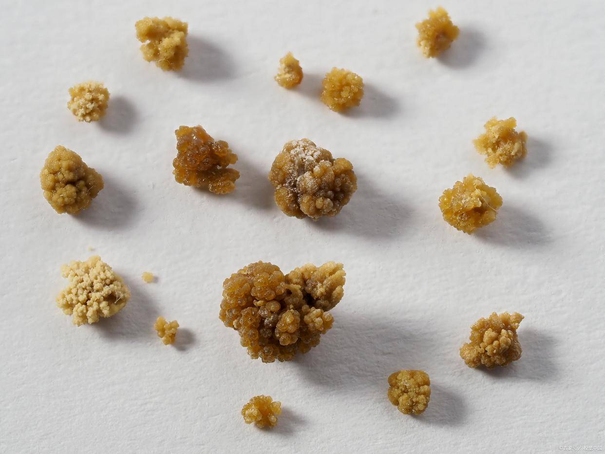 肾结石补钙用哪种钙片(肾结石服用哪种钙制剂)-硒宝网