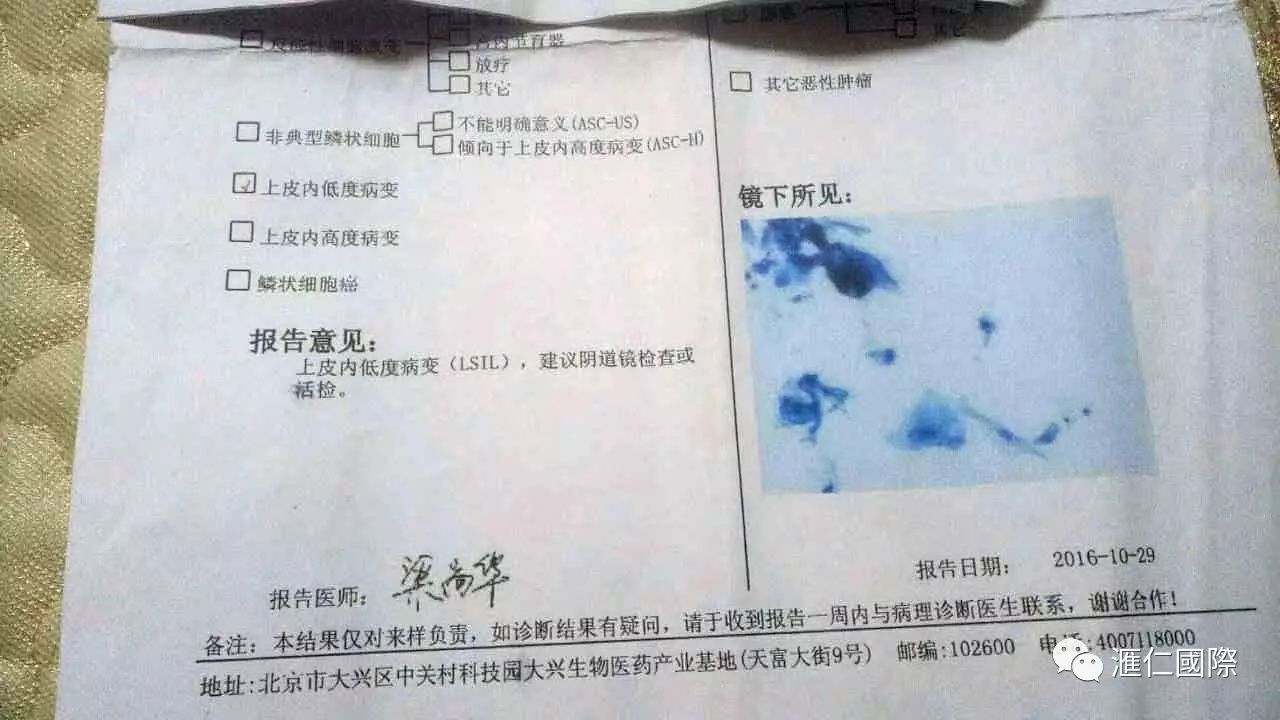 直肠癌能吃硒维康吗