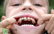 儿童换牙可以吃钙片吗?儿童换牙吃什么好？