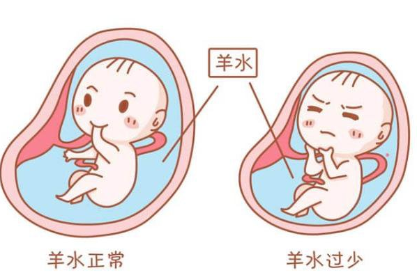 孕妇羊水少补硒有用吗(孕期补羊水)-硒宝网