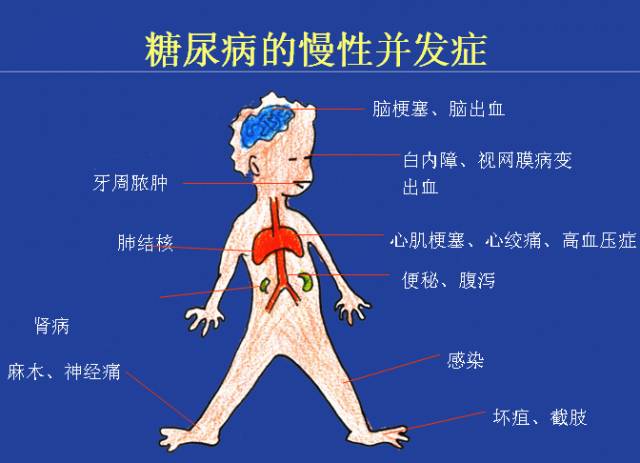得了糖尿病可以补硒吗
