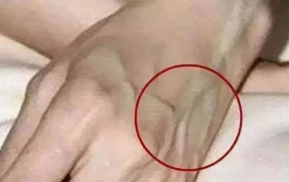补硒后睡眠好了吗女性