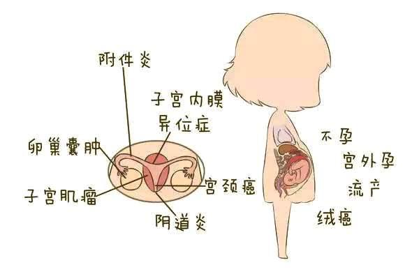 女人身体有炎症发生，宫颈癌找上门，吃维生素让HPV病毒落荒而逃