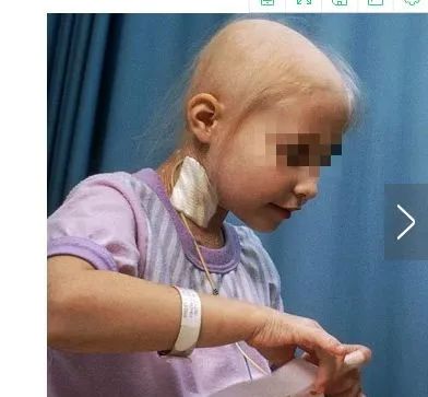 前列腺癌吃什么补硒好