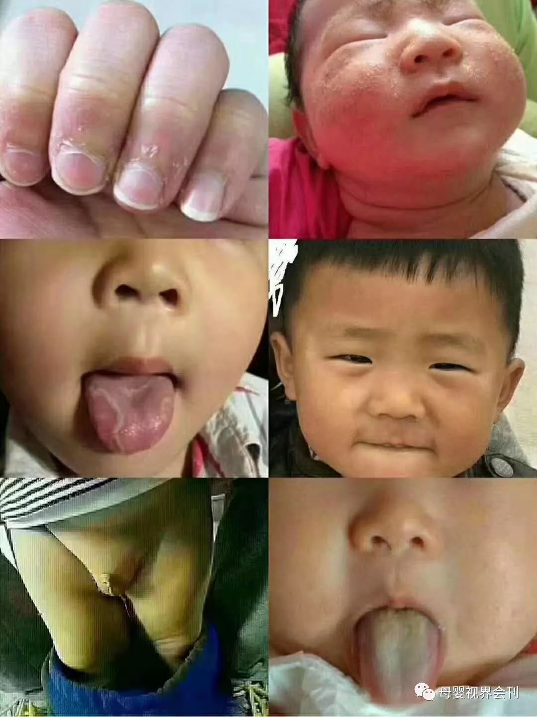 什么食物补锌效果最好