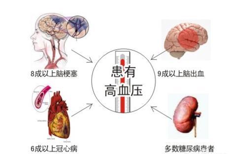 医生推荐三个防治高血压的食疗方法，最后一个最简单也最有效