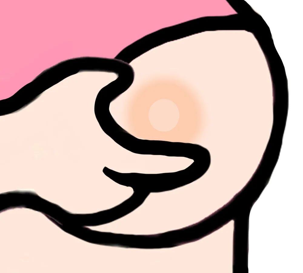 补硒导致乳腺增生加重吗