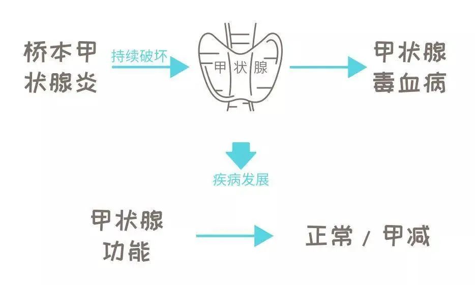 甲状腺要吃什么补硒药物
