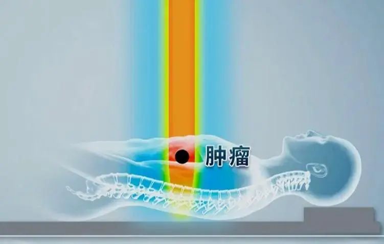 癌症患者为什么需要补硒(癌症病人补充硒起什么作用)-硒宝网