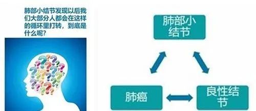 肺部有有结节可以补硒吗
