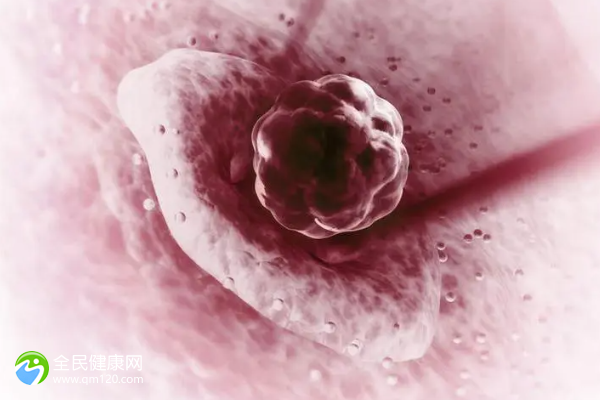 卵巢癌能不能喝蜂蜜？卵巢癌可以喝蜂蜜吗？
