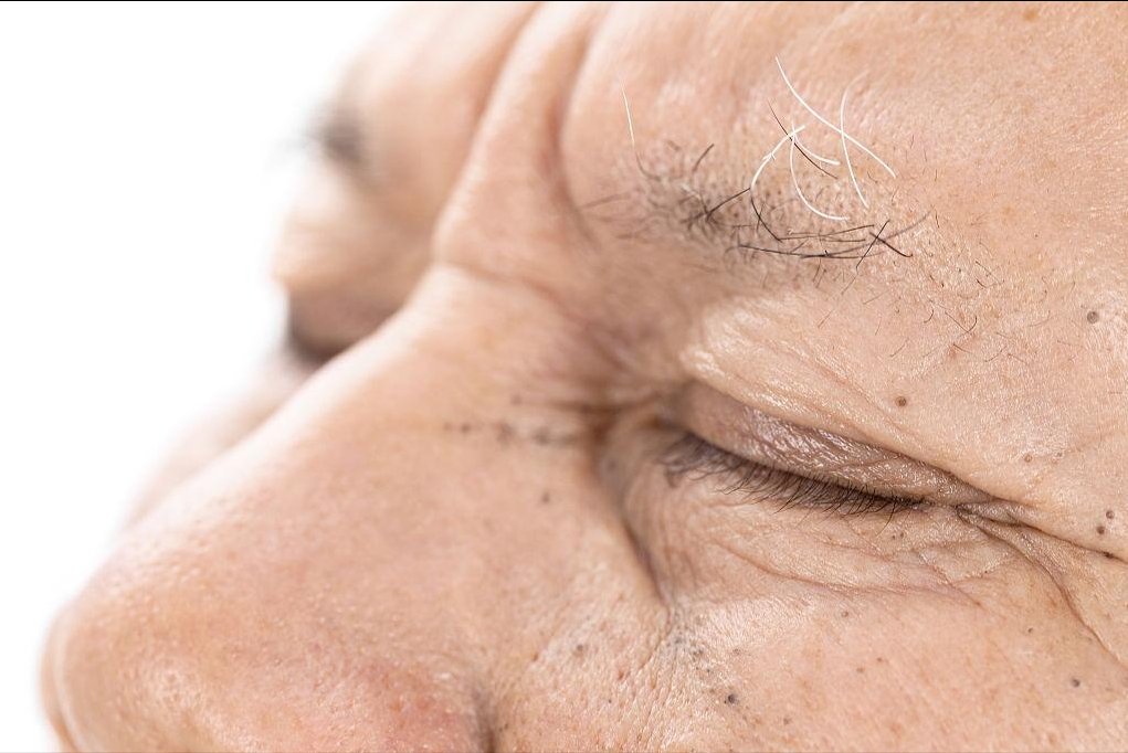 怎么知道是不是要补硒了(补硒很重要吗)-硒宝网