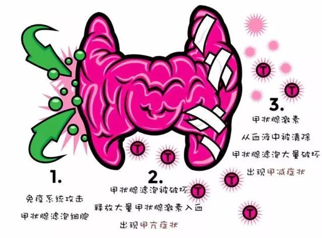 补硒可以调节甲状腺炎吗