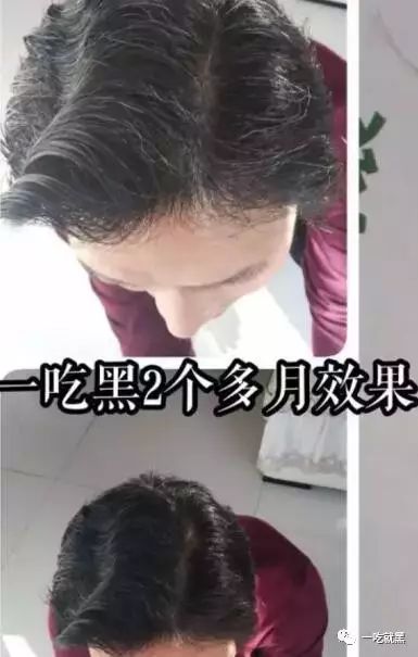男人补硒吃什么保健品好