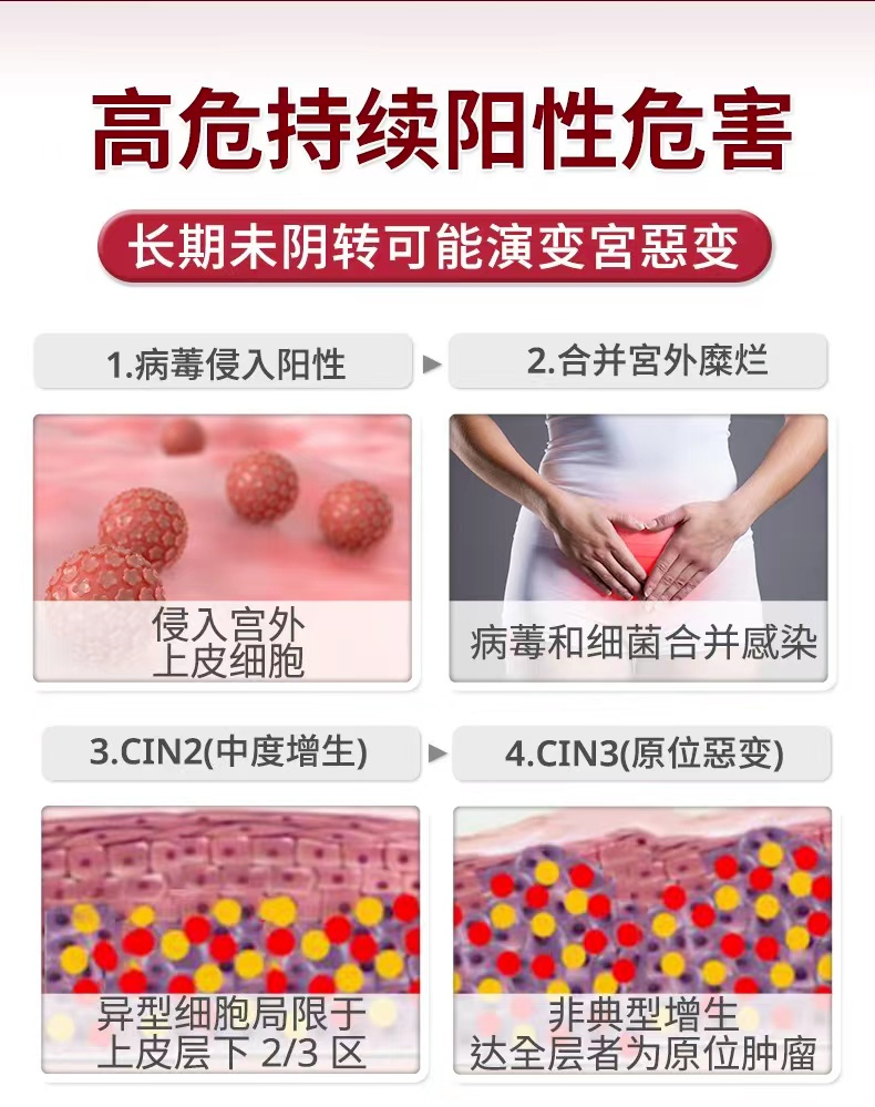硒片补硒推荐哪种好一点