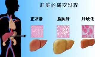 冠心病轻度脑梗能补硒吗