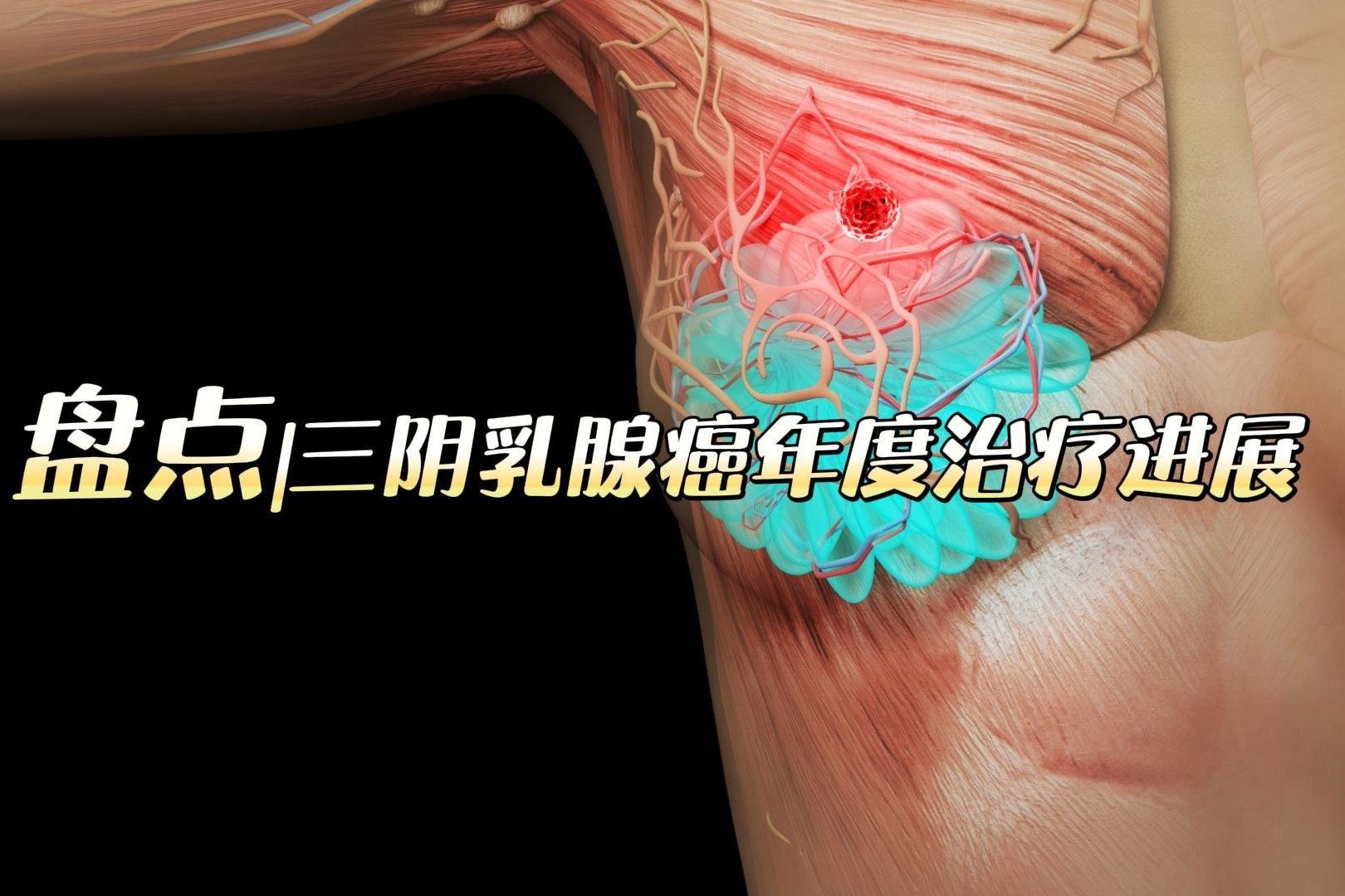 补硒防乳腺癌吗能治好吗