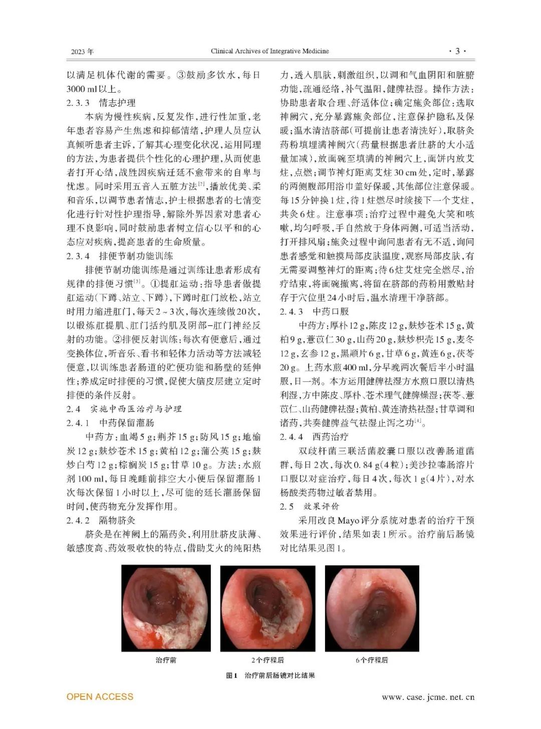 直肠癌能补硒吗中医治疗
