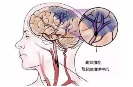 富硒的水果对身体的好坏