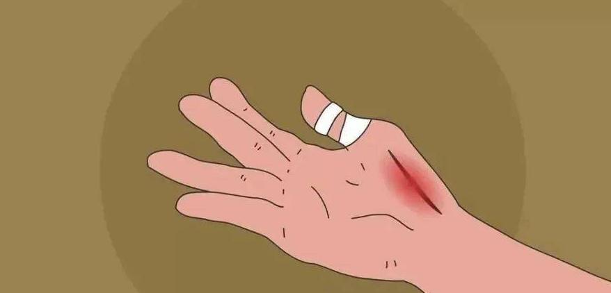 补硒可以治疗桥本甲状腺炎吗