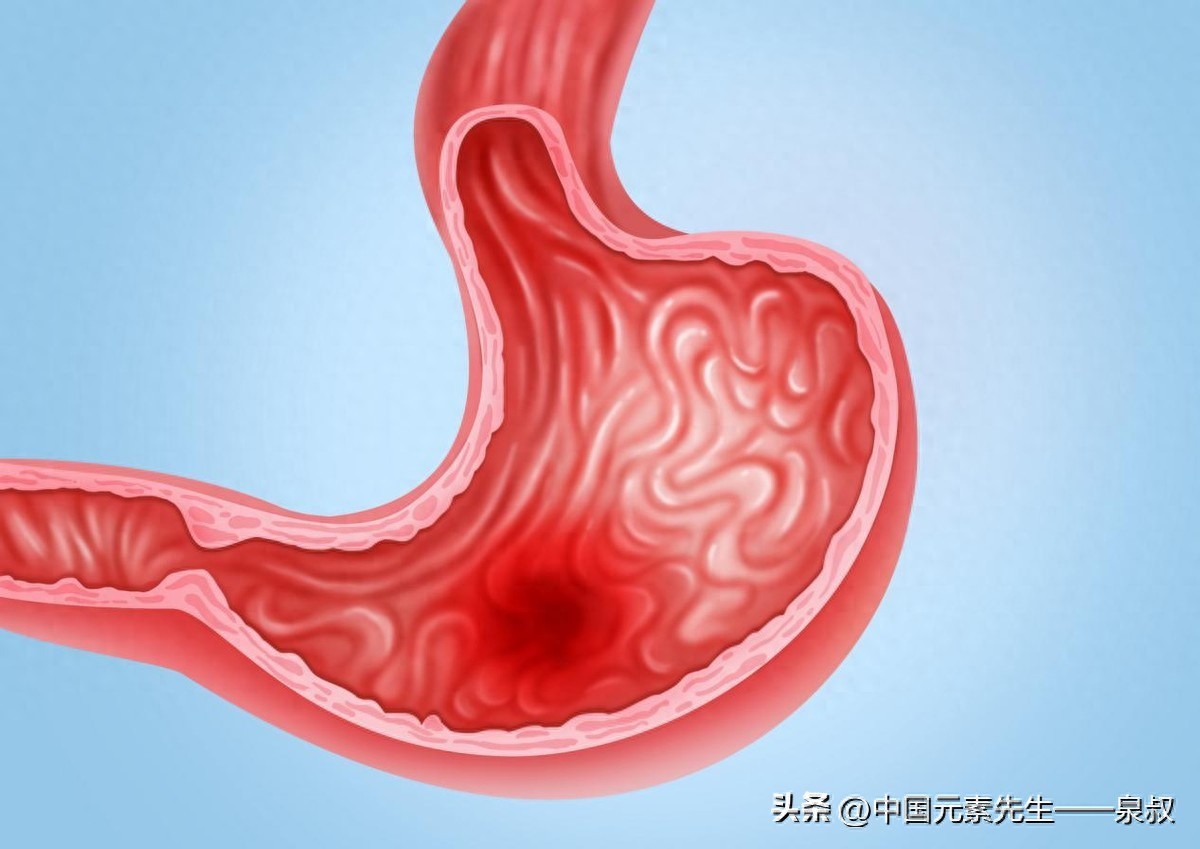 补硒改善胃病(中老年胃病硒元素)-硒宝网