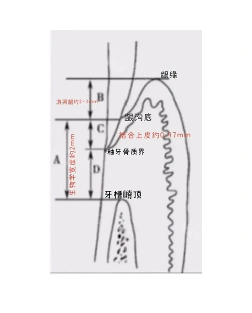 牙齿龈嵴顶位置