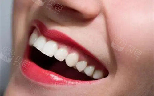 龈嵴顶与牙龈沟的区别