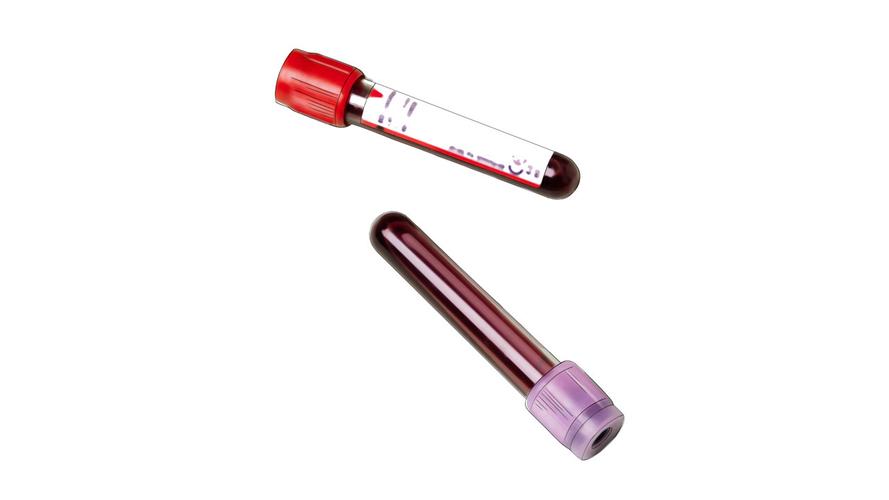 补硒类的药物(硒缺乏对健康的影响)-硒宝网