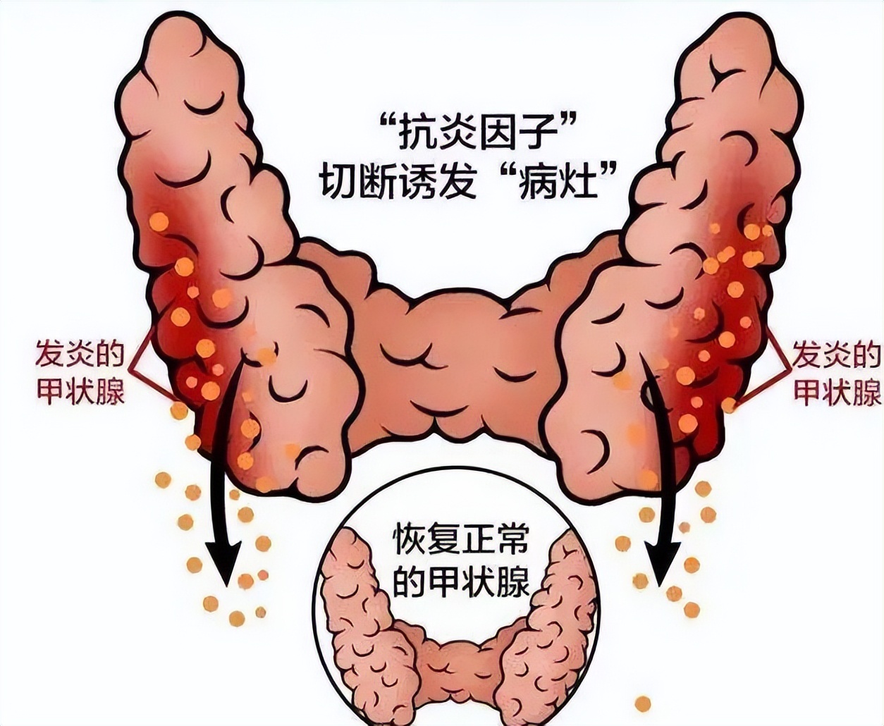 硒酵母补肺吗(硒酵母片桥本甲状腺炎用量)-硒宝网