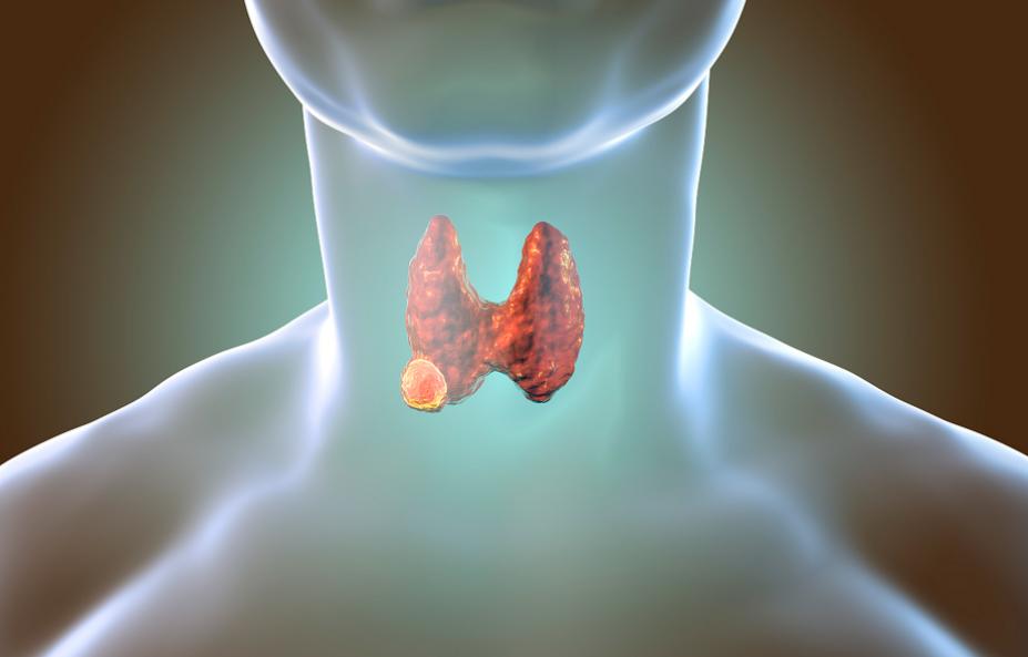 补硒降血糖吗(甲状腺饮食误区)-硒宝网