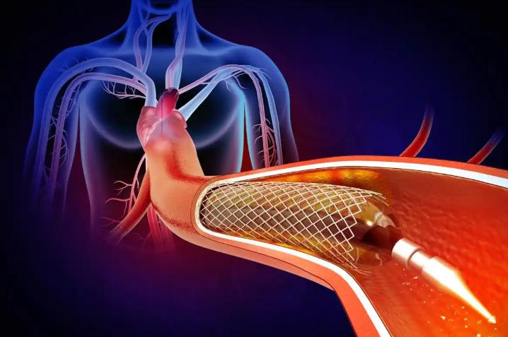 血脂高能补硒()-硒宝网